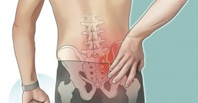 Is it my Sacroiliac Joint?